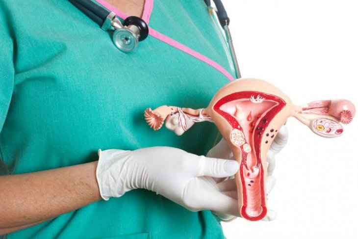 Ratusan perempuan Bengkulu deteksi dini kanker serviks