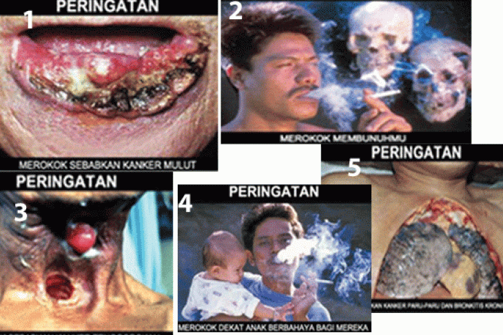 Gambar seram bungkus rokok akan lebih ngeri