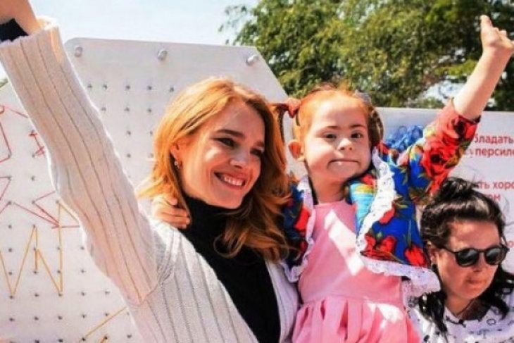 Ini dia, Gambaran kecantikan realistis ala perempuan Rusia di media sosial