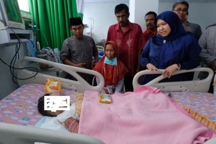 Bupati Masnah tengok Agung, bocah luka bakar
