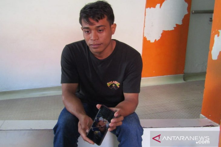 Bayi kembar siam asal Buleleng dirawat Intensif di RSUP Sanglah