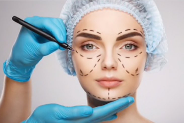 Operasi hidung pakai tulang iga jadi tren bedah plastik 2019