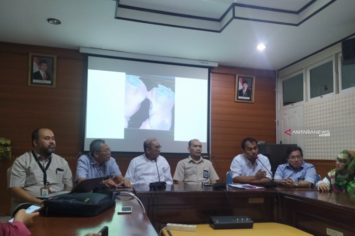 Bayi kembar siam Adam dan Malik jalani operasi pemisahan 23 Juli