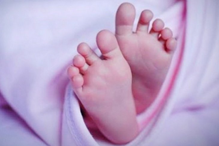 Bayi dari Medan Denai  ini  lahir dengan usus di luar perut