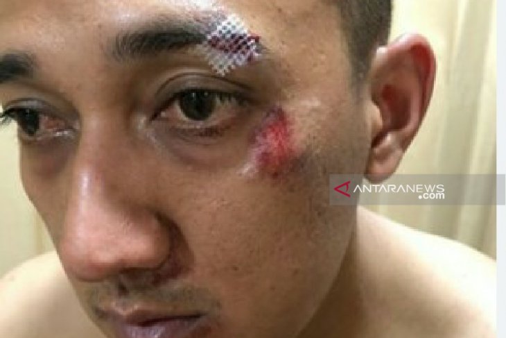 Bandar narkoba pengeroyok Kapolsek Patumbak ditembak