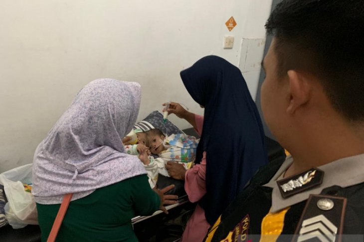 RSUD Cianjur rawat intensif bayi kembar siam bagian kepala