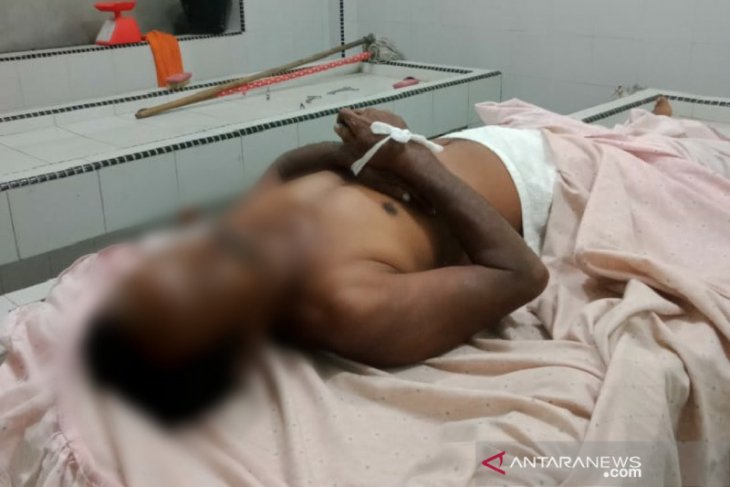 Diduga tak kuat konsumsi obat kuat, seorang pria ditemukam tewas di hotel
