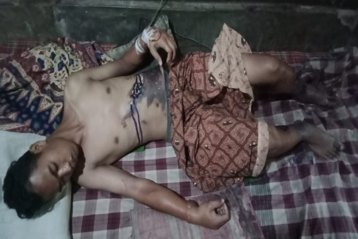 Warga Secanggang Langkat tersengat listrik tegangan tinggi