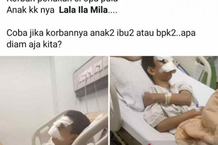 Seorang siswa SMP korban perundungan di Pekanbaru dirawat di rumah sakit