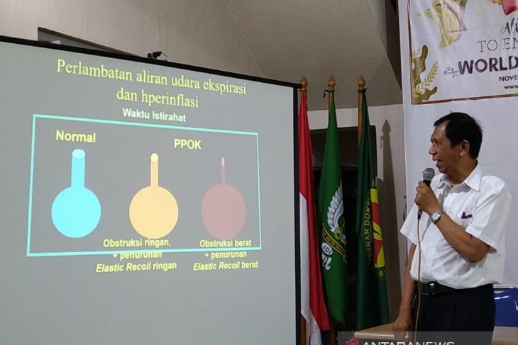 Pakar: Rata-rata perokok akan menderita PPOK dalam 20 tahun