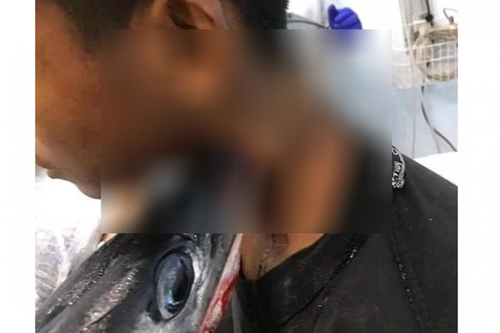 Muhammad Idul, pelajar SMP yang tertusuk ikan sori saat mancing