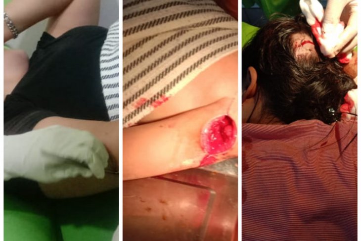 Satu keluarga di Stabat Langkat menjadi korban pembacokan
