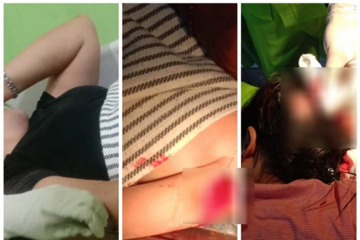 Akibat utang Rp1 juta, satu keluarga jadi korban pembacokan