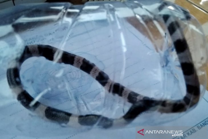 Jari bocah ini di patuk ular, beberapa saat kemudian meninggal