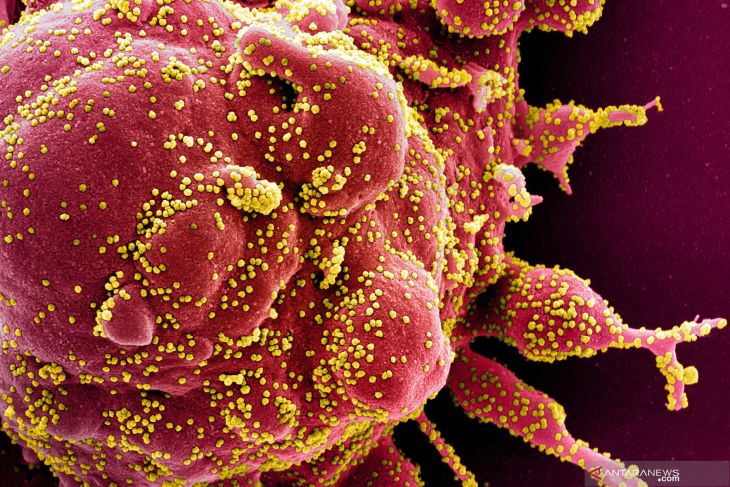 Gambar virus corona yang diambil dari sampel pasien