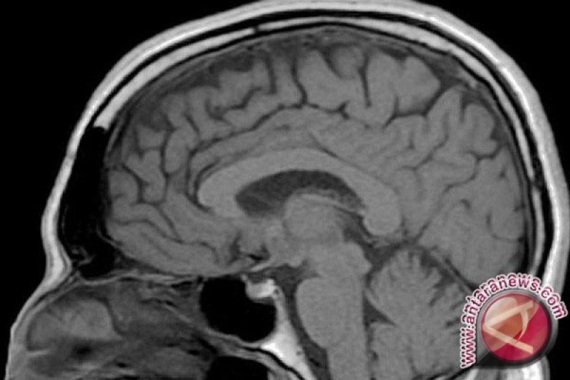 1.000 warga Vietnam terapi cuci otak dokter Terawan