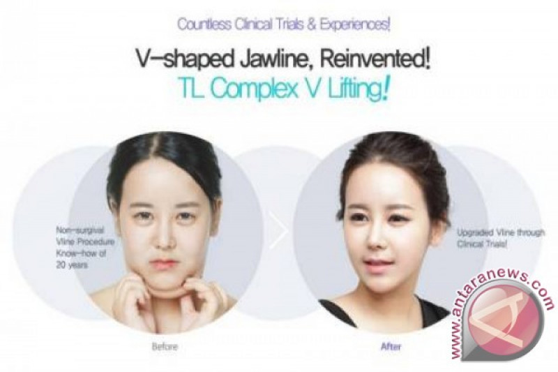 TL POWER V Lift non invasif dari Dr Jung Yeon Hu bantu Anda wujudkan wajah berbentuk V-line