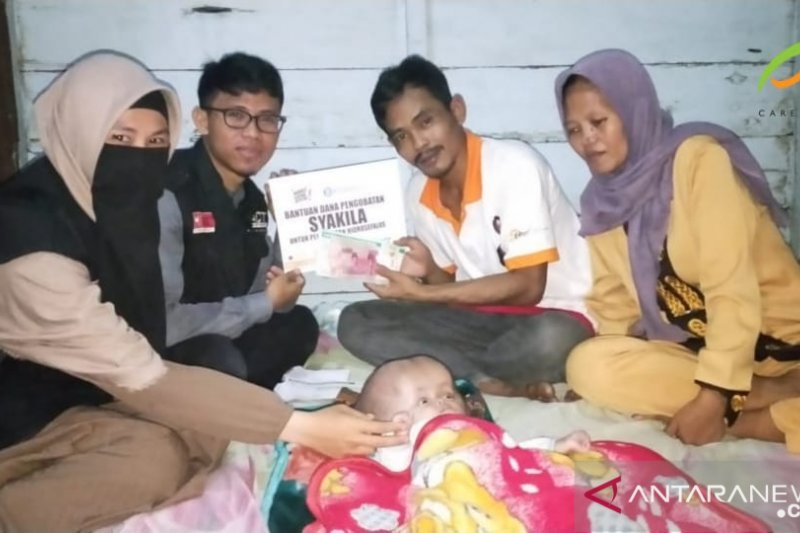 ACT Sumsel bantu pengobatan bayi penderita penyakit hidrosefalus