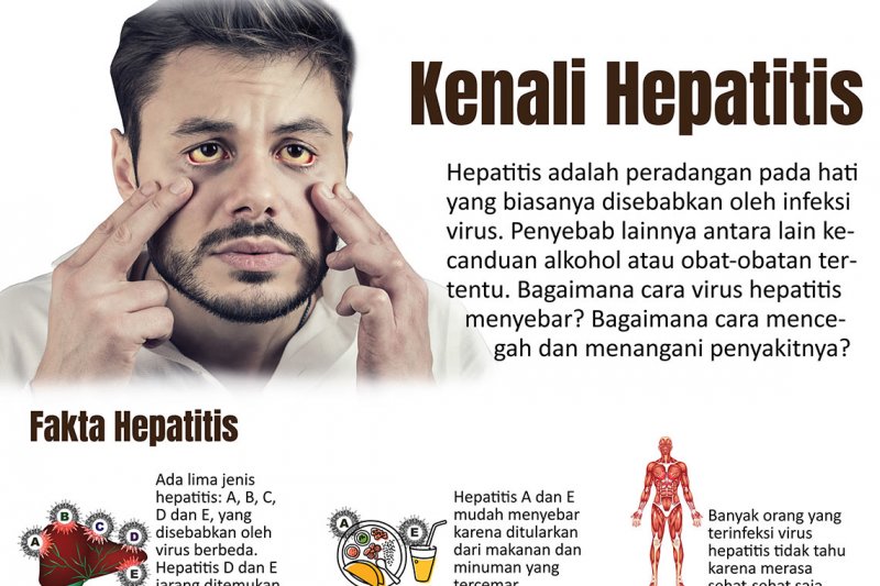 Jenis Penyakit Yang Disebabkan Oleh Virus Antara Lain ...