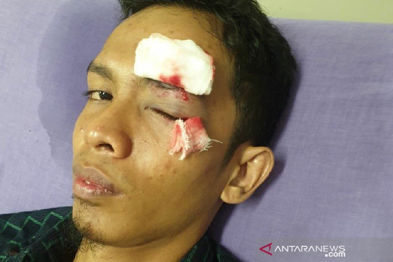 Tawuran di USU, tiga mahasiswa terluka