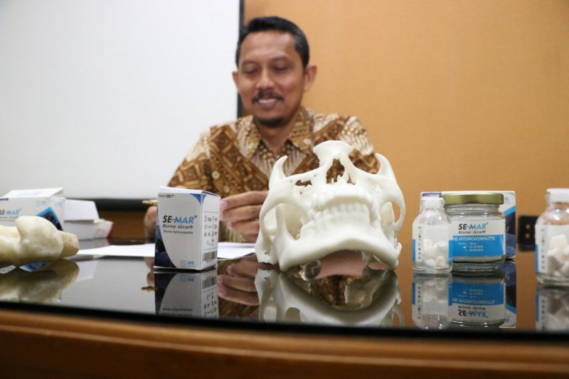 Dosen UNS temukan materi pengganti tulang rusak