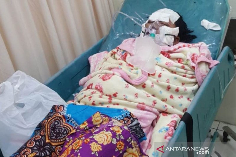 Diduga cemburu, suami nekat bakar istri di Surabaya