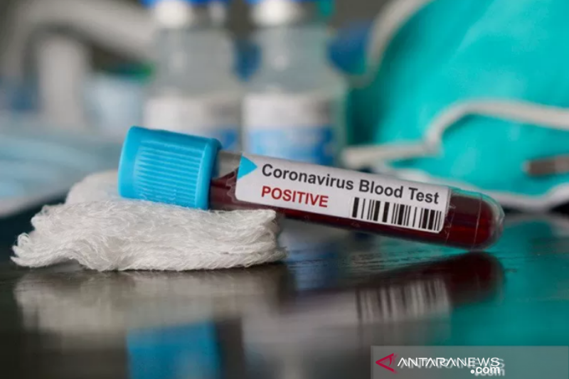 Satu Positif Covid 19 Di Sulawesi Tenggara Sembuh Antara News Banten