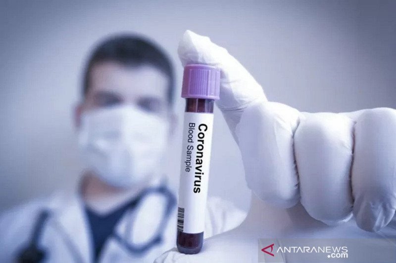 Laboratorium Amerika mulai menguji antibodi COVID-19
