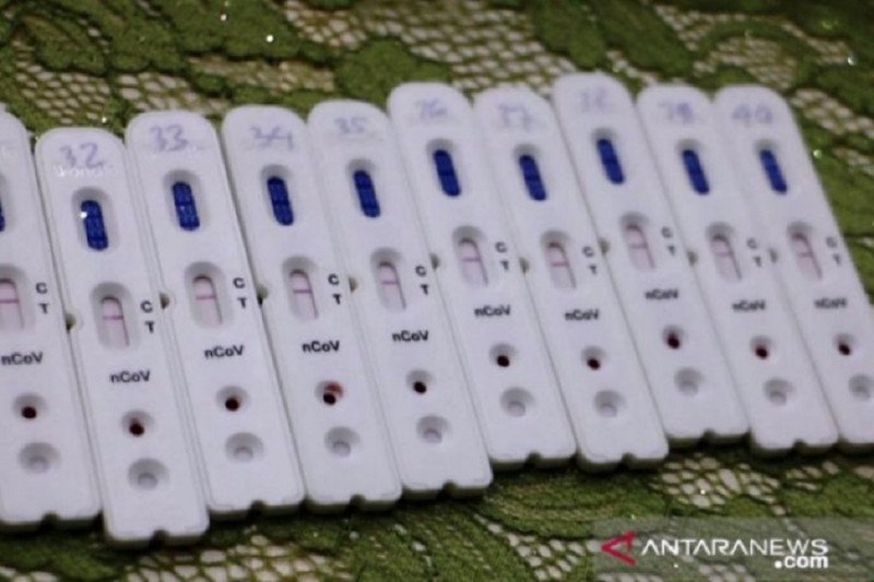 Ratusan ASN di Jombang jalani rapid test