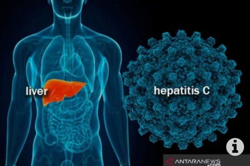 Sudinkes Jakpus menyinyalir penularan hepatitis akut dari makanan