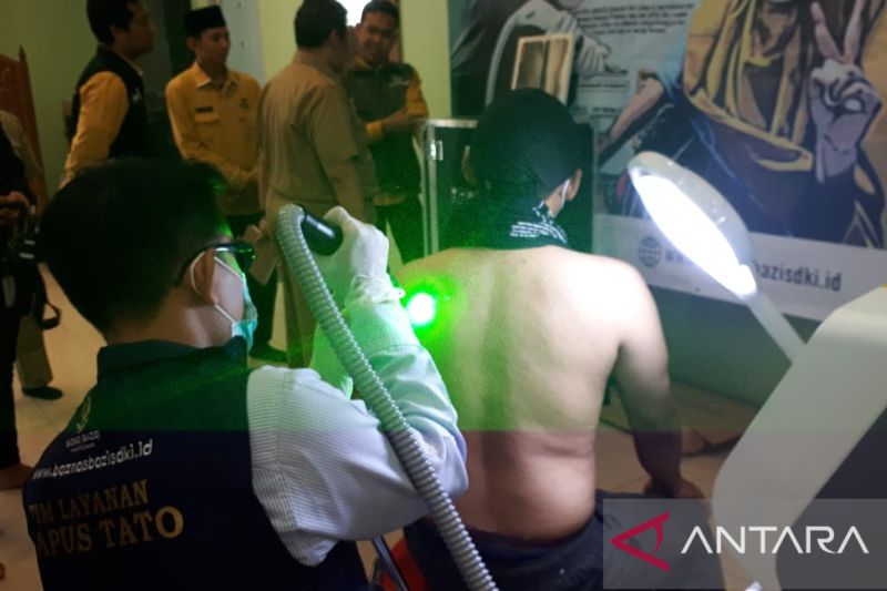 Pemkot Jakbar sediakan layanan hapus tato gratis selama Ramadhan