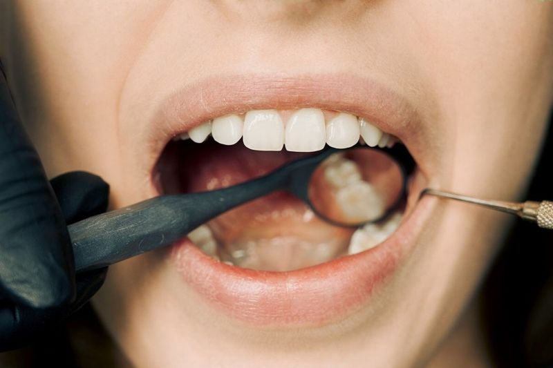 Kiat jaga kesehatan gigi dan mulut selama berpuasa