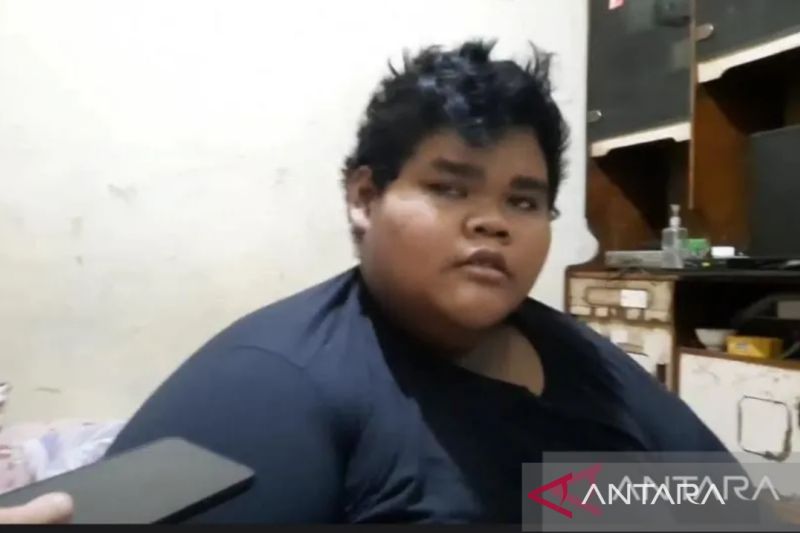 Puskesmas dan RS DKI diminta rutin mendata anak berpotensi obesitas 