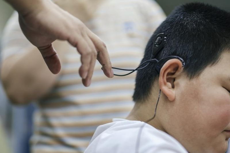 Hampir 90 persen anak tunarungu di China gunakan implan koklea