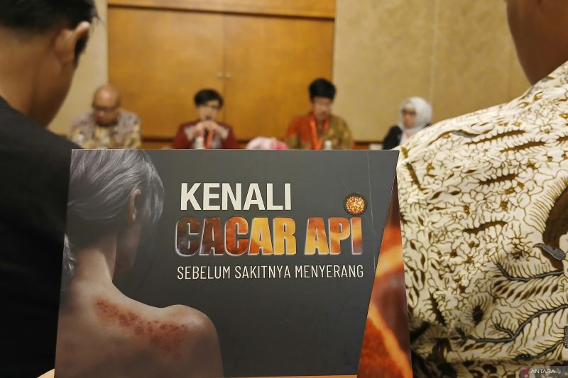 Satgas imunisasi dewasa sebut pentingnya vaksinasi cacar api