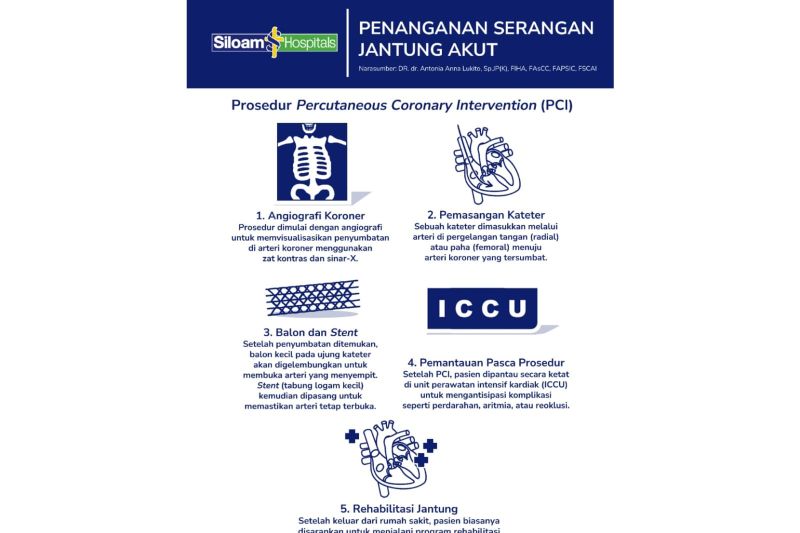 Mengenal gejala dan prosedur PCI untuk serangan jantung akut