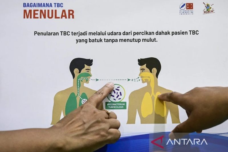 Mengais ontel demi jemput pasien TBC di Pela Mampang