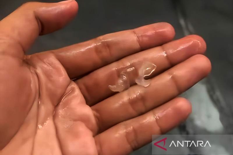 Fenomena hujan es kembali melanda wilayah Tangerang